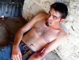 Amphetamine Overdose Amphetamine Addiction Overdose